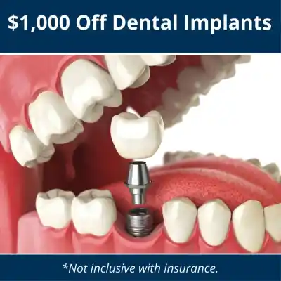 implant special